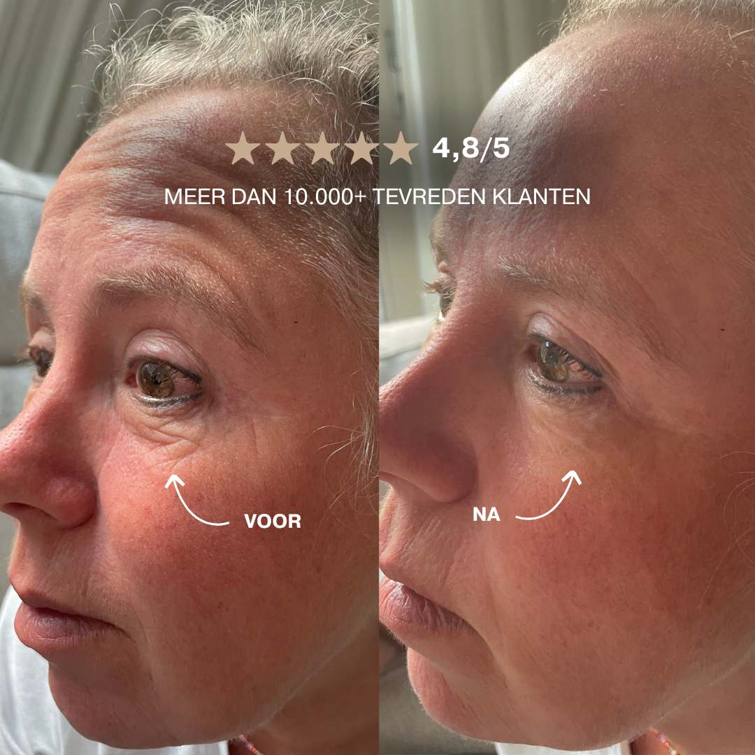 Instant Wrinkle Lift