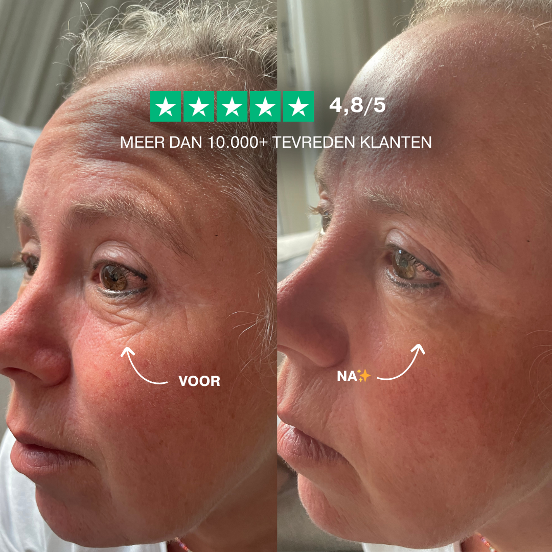 Instant Wrinkle Lift